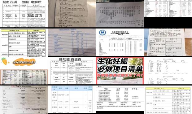 汕头生化常规检查多少钱