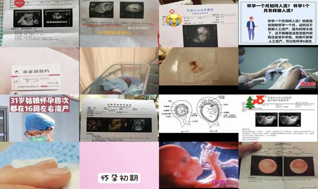 汕头怀孕16周能做流产吗