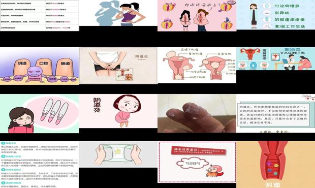 汕头阴道炎会不孕吗