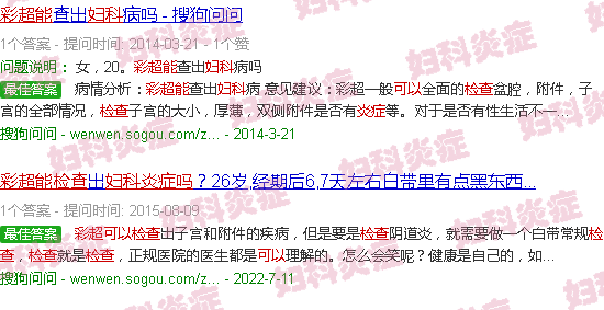 汕头彩超能检查妇科炎症吗