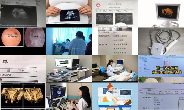 汕头彩超能检查妇科炎症吗