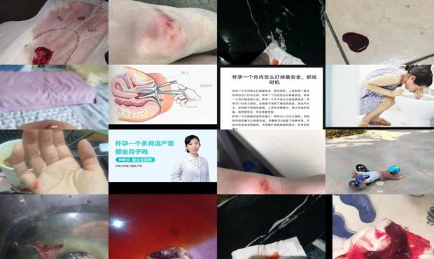 汕头怀孕一个多月摔了一跤会流产吗