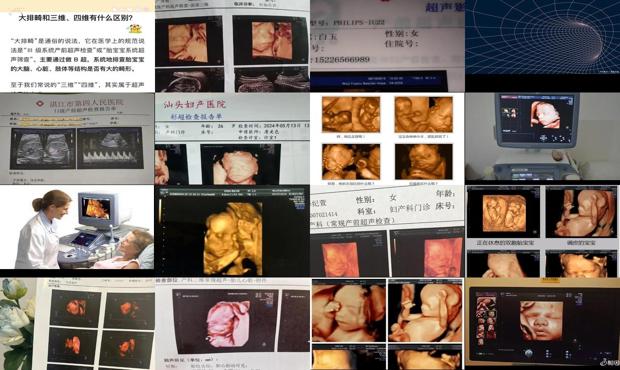 汕头没做三维和四维怎么办