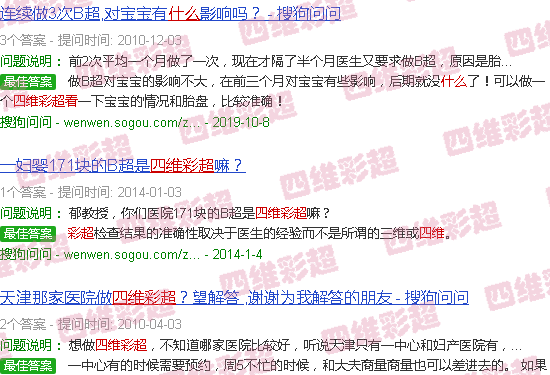 汕头四维彩超看什么