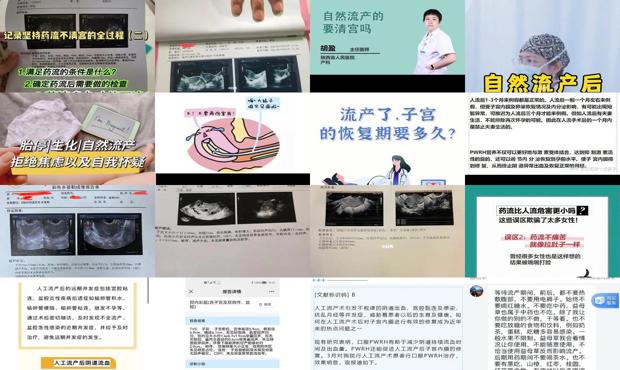 汕头自然流产后怎么判断要不要清宫
