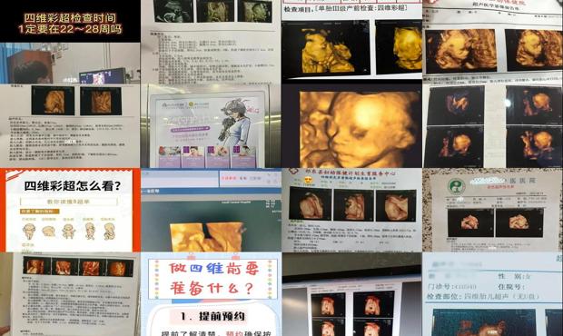 汕头做四维的*佳时间是多少周?