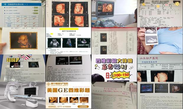 汕头四维彩超的价格