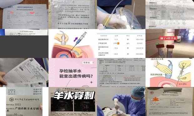 汕头抽羊水检查能查出什么