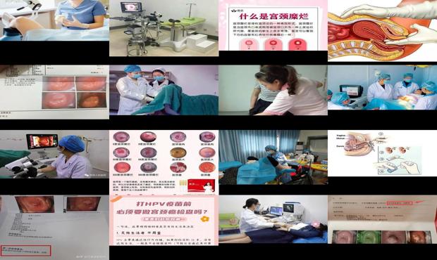汕头检宫颈需要做什么检查
