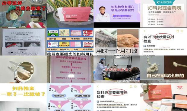 汕头去哪检查妇科炎症