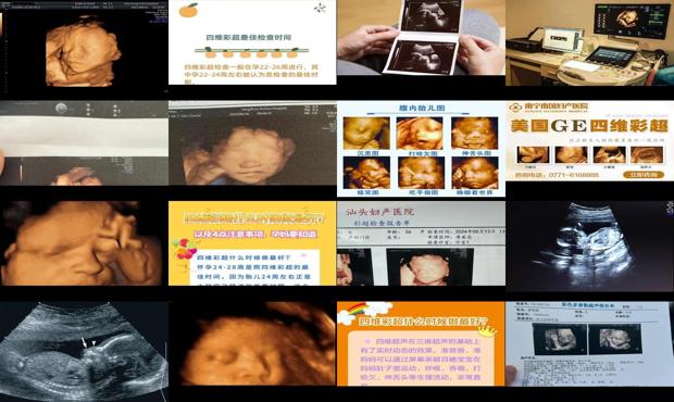 汕头什么时候做四维*好