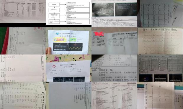 汕头心肌炎怎么检查出来