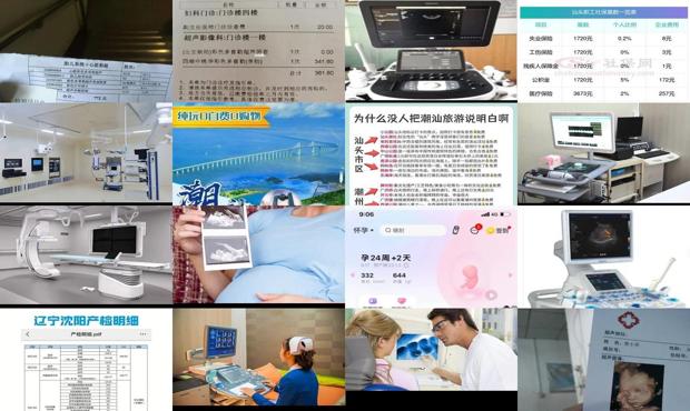 汕头四维的费用一般多少钱