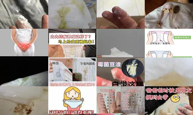 汕头妇科炎症有豆腐渣腰酸