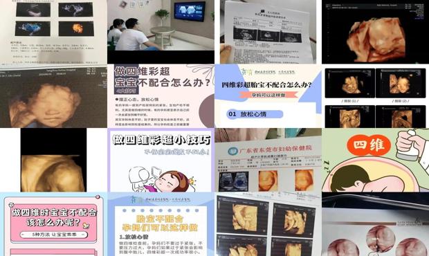 汕头做四维宝宝不配合怎么办
