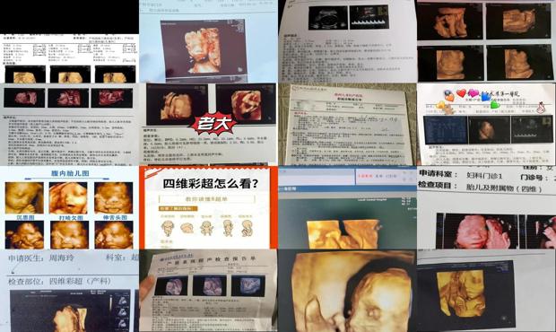 汕头几周四维*好