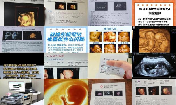 汕头怀孕四维彩超多少钱