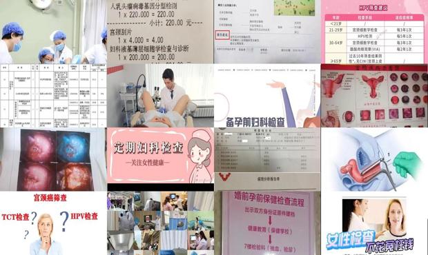 汕头妇科检查*检查什么
