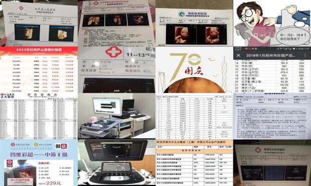 汕头四维彩超2019价格表