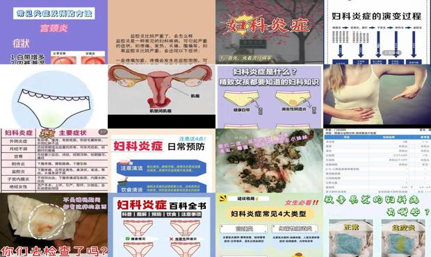汕头妇科炎症2度严重会怎么样