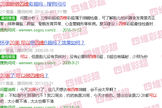 汕头20周可以做四维吗