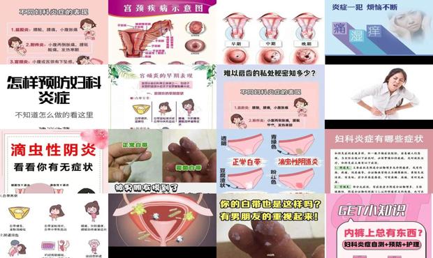 汕头如果有妇科炎症有什么症状