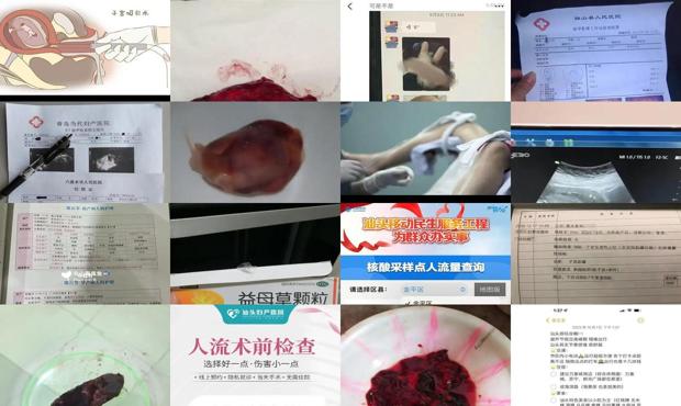 汕头八个月怎么弄能流产