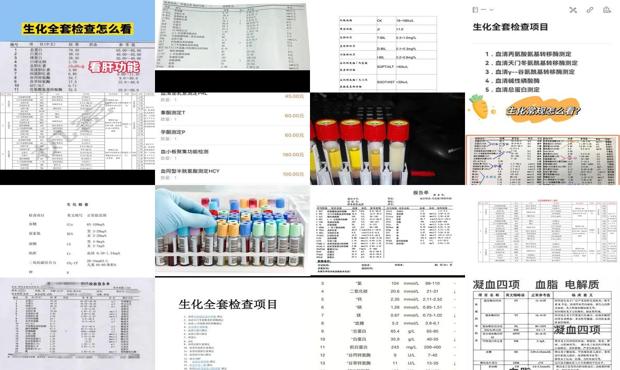 汕头检查生化*套多少钱