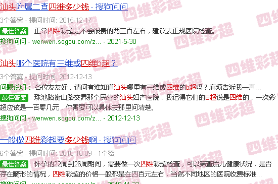 汕头b超四维多少钱