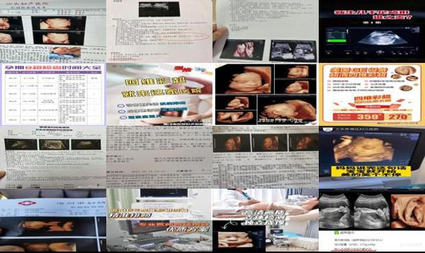 汕头四维排畸检查多少钱