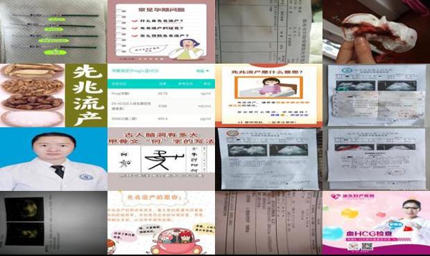 汕头先兆流产是何意思