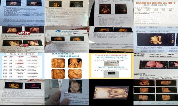 汕头四维彩超能确定什么