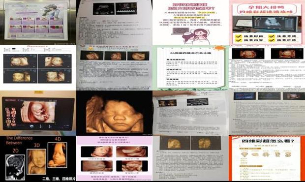 汕头查四维彩超*佳时间