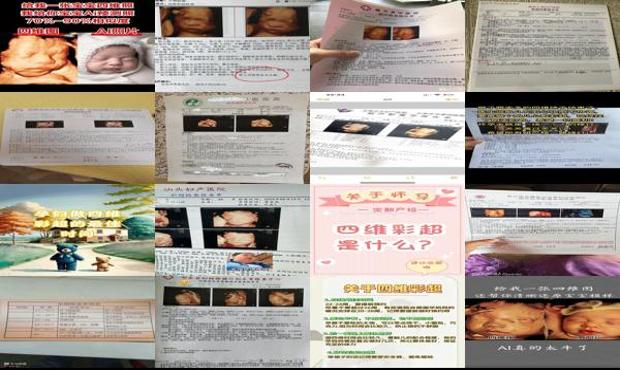汕头怀孕做四维*佳时间