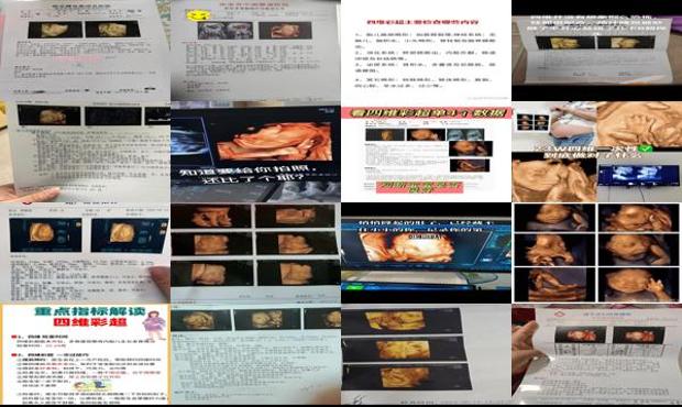 汕头四维主要检查什么