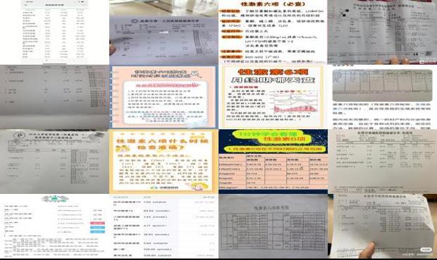 汕头性激素检查能检查时间
