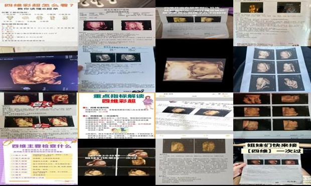 汕头四维彩超是关于什么