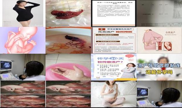 汕头有刚怀孕*流产的吗