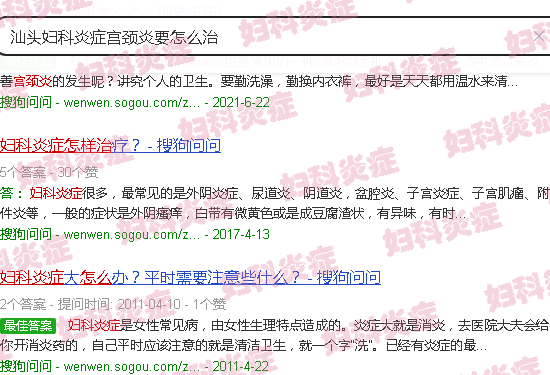 汕头妇科炎症宫颈炎要怎么治