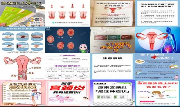 汕头妇科炎症宫颈炎要怎么治