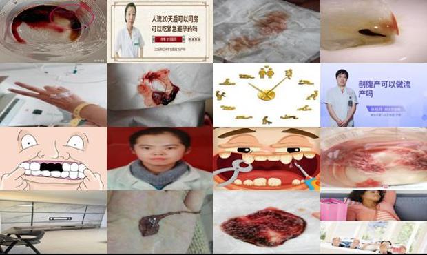 汕头房事后20天能做流产吗