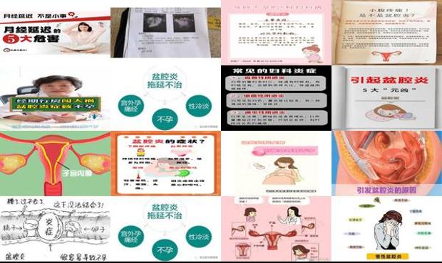 汕头急性盆腔炎会不会导致不孕