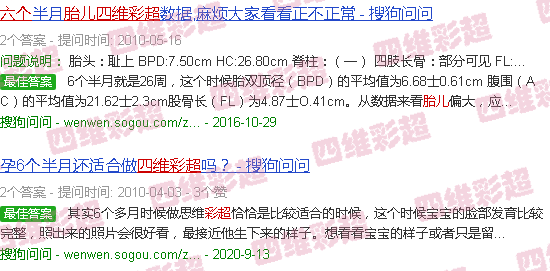 汕头胎儿六个月的四维彩超图