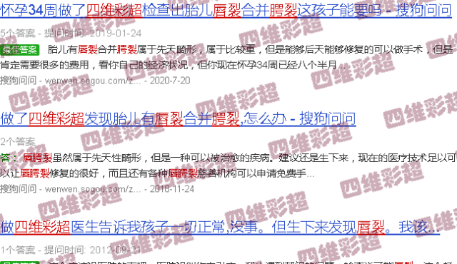 汕头四维彩超唇腭裂