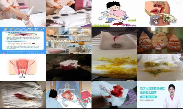 汕头坐月子拉屎出血怎么办