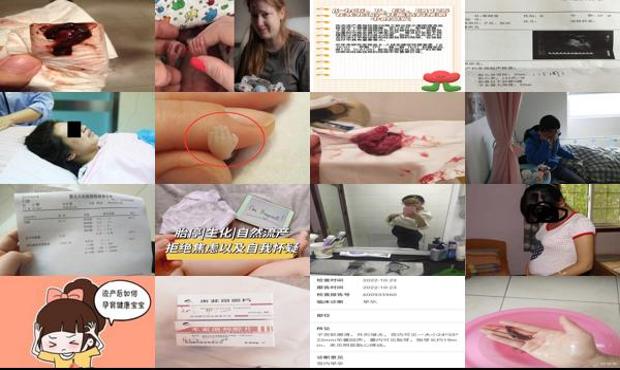 汕头怀孕15周可以流产吗